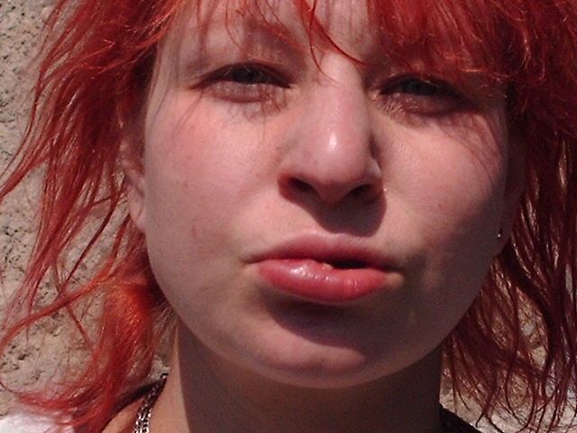 What Happens When Your Face Meets A Telephone Pole At 33.3333333 MPH????